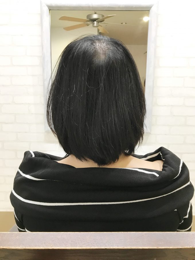脱毛症のお客様 大事なのは髪の量より清潔感 広島市八丁堀駅近くの美容院 チャミクール
